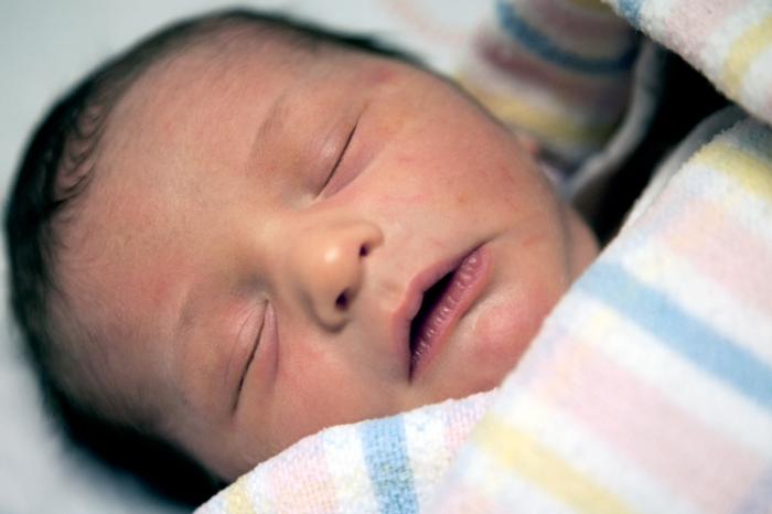Кората на главата на новородено: струва ли си да се притеснявате и как да го премахнете?