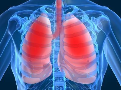 как да се лекува пневмония 