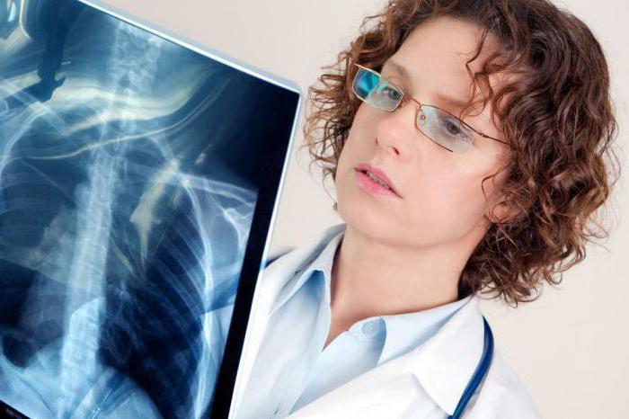 Pleurisy с рак на белите дробове: описание, причини, симптоми и лечение