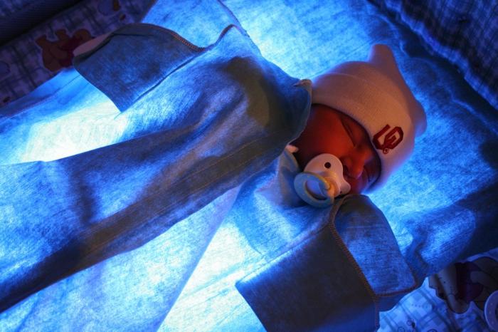 Повишен билирубин при новородени: причини